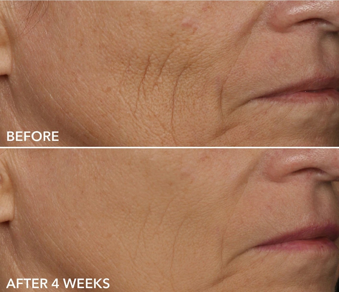 SkinLab Stem Cell Microneedling Solution