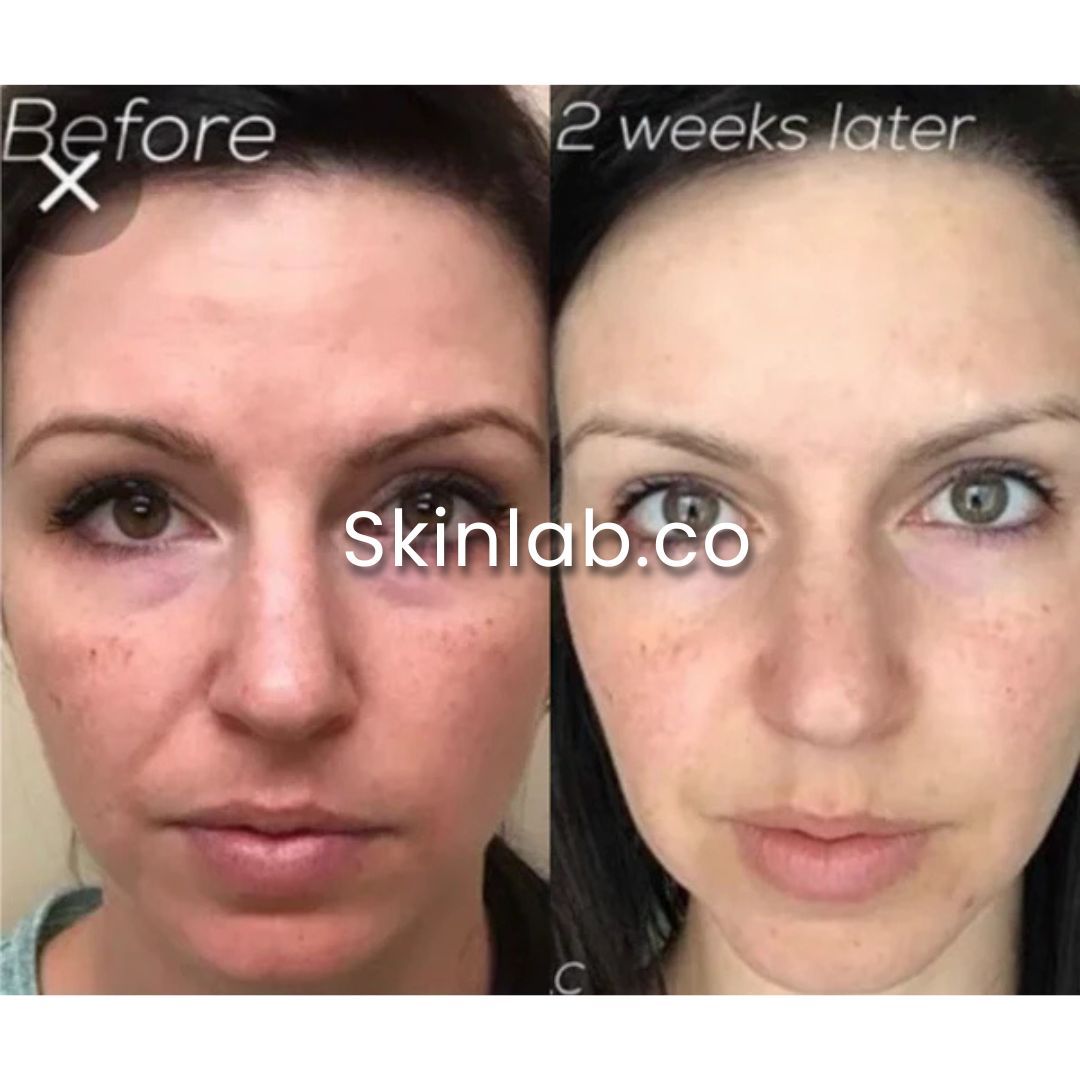 SkinLab Stem Cell Microneedling Solution